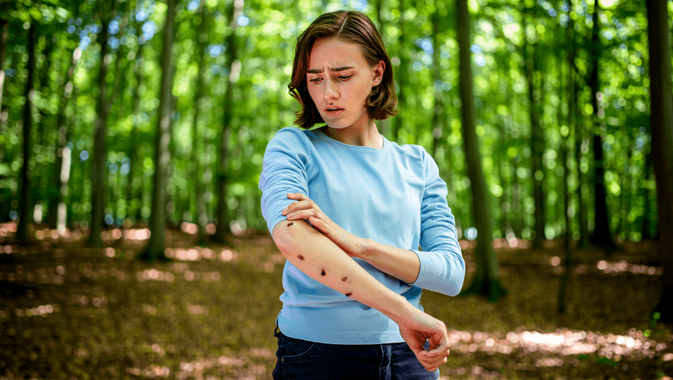 4 Types of Tick Bite Illness and How to Use Holistic Support
