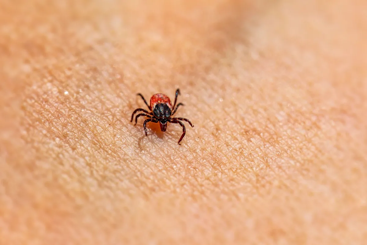 Tique attachée à la peau, principal vecteur de transmission de la maladie de Lyme