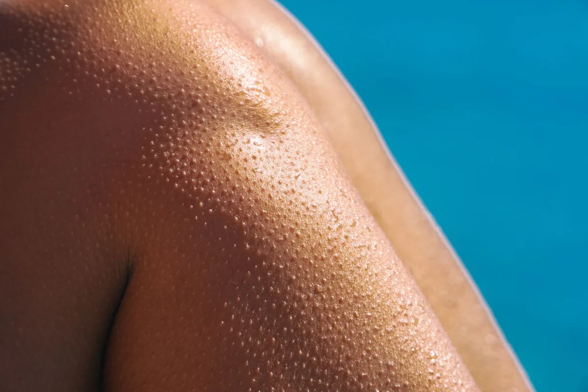 Peau exposée aux agressions estivales : soleil, eau de mer et chaleur.