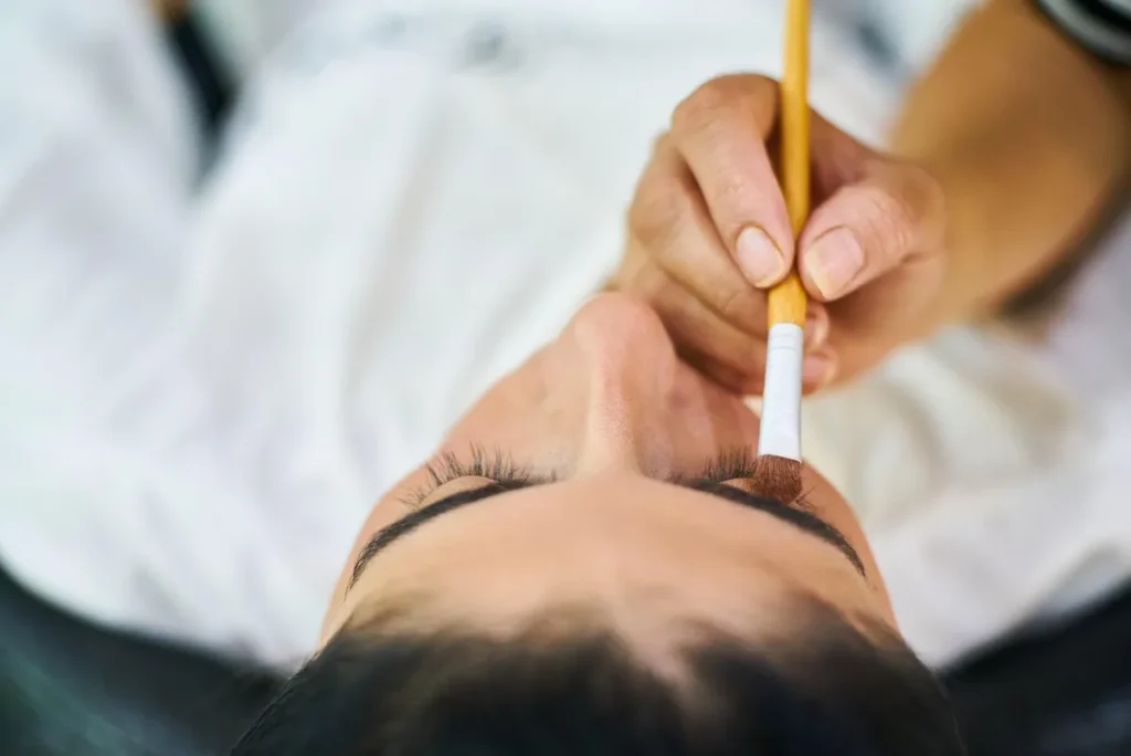 Mains appliquant délicatement un soin après-soleil sur une peau rougie par le soleil