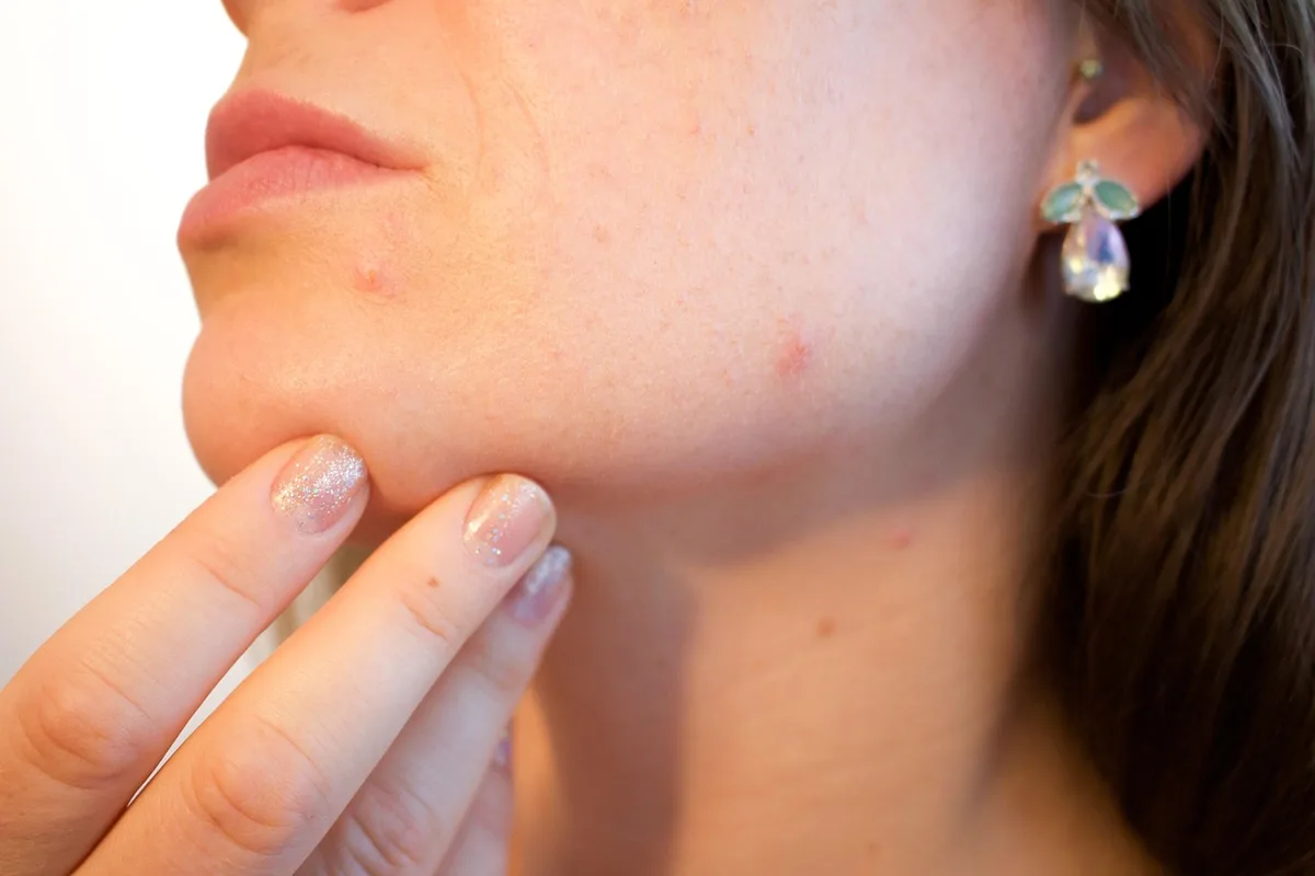 Manifestations cutanées et réactions dermatologiques, illustration des effets indésirables possibles
